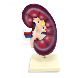 Human Kidney Model