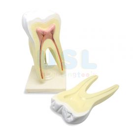 Model Of Human Molar Tooth