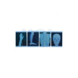 X-Ray Film 4 Piece Set