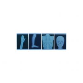 X-Ray Film 4 Piece Set